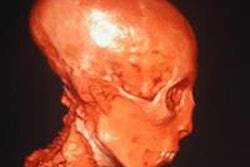 2014 09 11 12 07 05 974 2014 09 12 Icr Mummy 14 King Tut 20140912151511