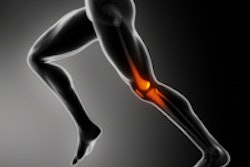 2014 05 28 17 24 06 741 Running Knee Pain 200