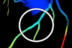 2014 10 01 16 52 10 498 Schoepf Ct Based Ffr 200