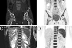 2014 10 03 13 18 53 111 Pet Mri Ct Pedx Rad 01 400 20141003202554