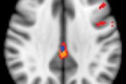 2014 10 07 10 07 25 297 Asl Mri Cortex Larger 400 20141007171515