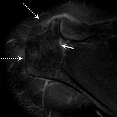 2014 10 14 09 21 33 952 Mri Roedl Fig3b 400