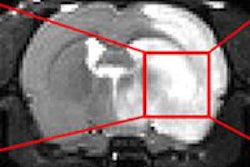 2014 10 16 11 37 53 593 Fsu Lab Mri Grant 01 800 20141016183826