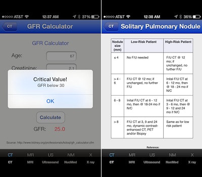 Radiology Toolbox Pro's glomerular filtration rate (GFR) calculator and solitary pulmonary nodule guidelines chart as seen on an iPhone. All images courtesy of Dr. Eric Baumel.