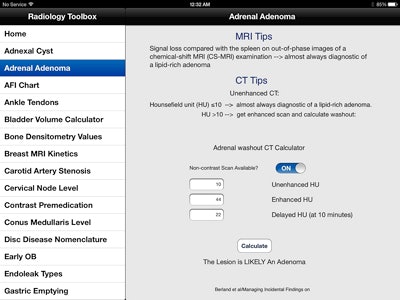 Radiology Toolbox Pro's adrenal adenoma CT washout calculator as seen on an iPad.
