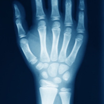 2014 10 22 13 29 49 951 Wrist X Ray 200