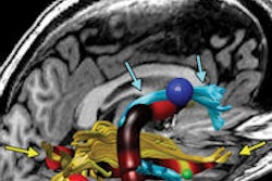 2014 10 28 15 59 47 166 Rad Mri Fatigue Image 01 200