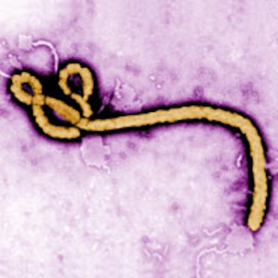 2014 11 17 16 38 39 984 Ebola 200
