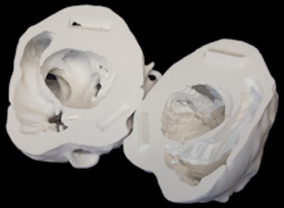 A 3D printed heart is split in half to reveal its internal structure.