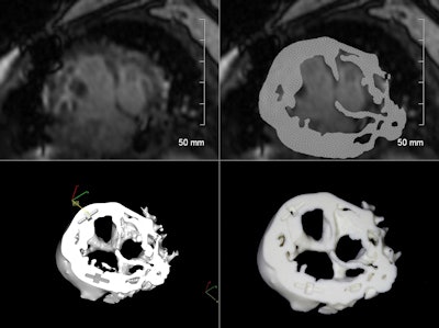 Cardiac MR images before (top) and after (bottom) reconstruction in preparation for 3D printing.