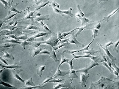 Mesenchymal stem cells from an umbilical cord segment. Courtesy of Prof. John Davies, www.verypowerfulbiology.com.