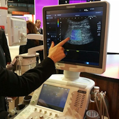 Toshiba's shear-wave elastography provides quantitative analysis and dynamic visual display of tissue stiffness.