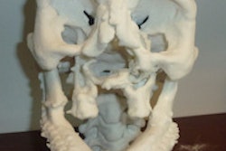 2014 12 01 18 27 56 447 Face Transplant 200