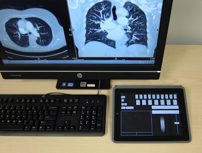 The iPad app brings touch control to PACS workstation software. Image courtesy of Dr. Gabriel Howles-Banerji, PhD.