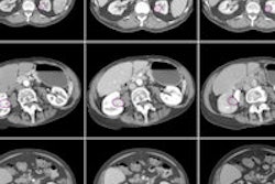 2014 12 02 18 00 53 987 Raman Kidneylesions 200