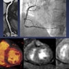 2014 12 05 12 32 34 334 Ko Cardiac 200