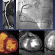 2014 12 05 12 32 34 334 Ko Cardiac 200