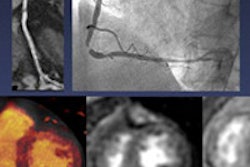 2014 12 05 12 32 34 334 Ko Cardiac 200