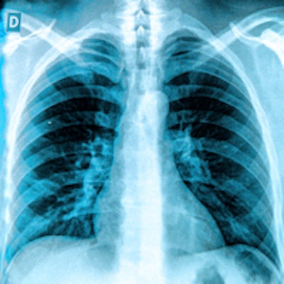 Lung cancer screening was the focus of several sessions.