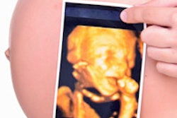 2014 12 16 10 50 32 470 Pregnant Ultrasound 200