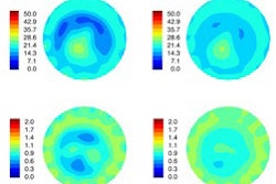 2014 12 16 11 34 54 622 Breast Microwave Sm