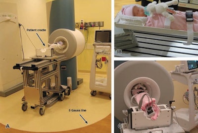 The modified compact MRI scanner (A) sits in the hospital's NICU, while one neonate waits (B) to be imaged and monitored (C). Images courtesy of Laura Walkup, PhD, and the American Journal of Roentgenology.