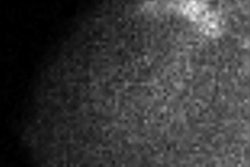 2015 01 26 16 40 26 351 Mbi Mammo 200
