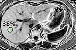 2015 02 05 10 35 06 8 Schwimmer Fat Mri 400 20150205173701