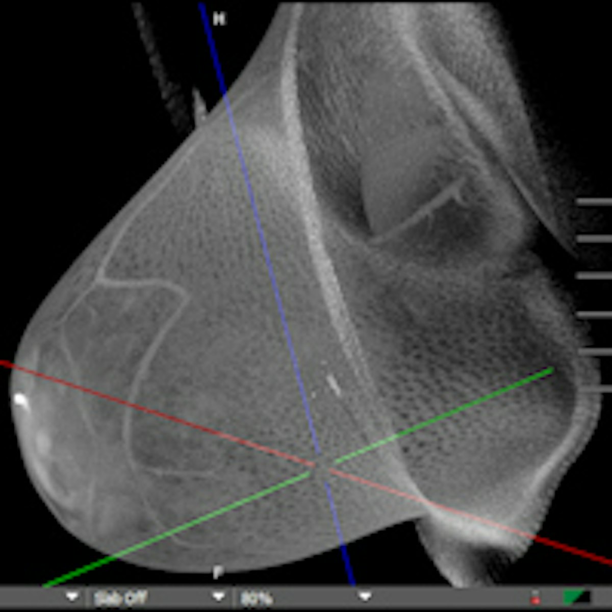 Diagnostic Breast Imaging 第2版 Diagnostic Breast Imaging: Mammography, Sonography, MRI and