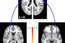 2015 02 23 17 10 36 922 Kayser Figure5 Aan 200