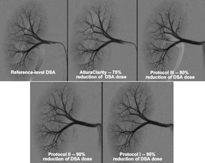 Renal angiogram in animal studies shows change in image quality with different dose-reduction protocols. Image courtesy of Dr. John Racadio.