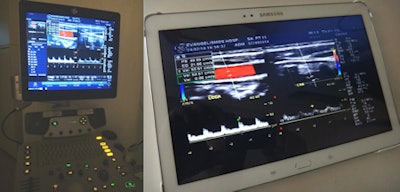 The wireless system makes use of a hardware video compression device that provides full high-definition video streaming to tablets, PCs, or laptops. Image and videos courtesy of Dr. Vasileios Moustakas.