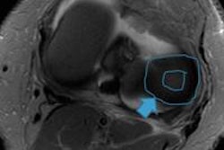 2015 03 05 23 33 41 550 2015 03 06 Ecr Today Knee 20150306063750