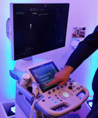 GE's new Logiq P9 ultrasound scanner.