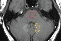 2015 03 26 16 51 08 732 Gbca Dentate Rad Mc Donald 200