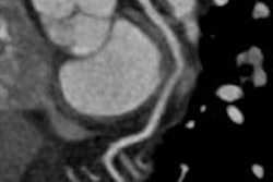 2015 04 08 10 22 33 483 2015 04 13 Meinel Ccta Thumb