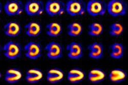 2015 04 09 16 27 05 612 2015 04 10 Lowdose Spect Einstein Jnm 400 20150409232907