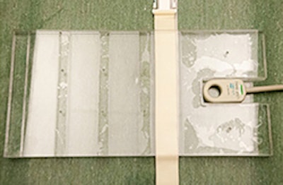 Radiofrequency coil inside clear housing