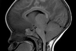 2015 04 16 17 10 12 186 Cerebral Malaria Image Taylor 200