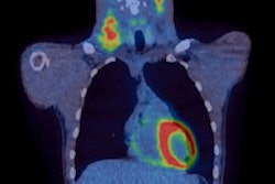 2015 04 23 09 37 08 112 2015 04 23 Nejm Pet 200
