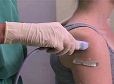 A posterior approach was used in the study. All images courtesy of Alex Trinh.