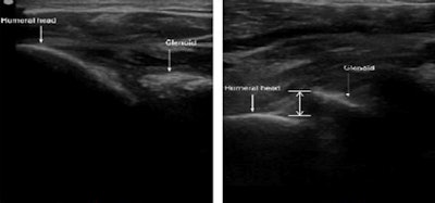 2015 04 24 12 40 53 596 Shoulder Scan 800