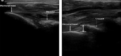 2015 04 24 12 40 53 701 Shoulder Scan 350