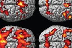 2015 04 27 16 45 11 749 F Mri Brain Mbti Rad Chen 20150427234555