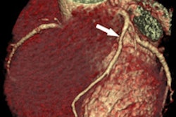 2015 05 08 16 46 14 445 2015 05 Zhang Above 200