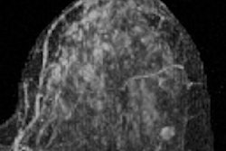 2015 05 12 09 14 56 87 Dontchos Fig1d 200