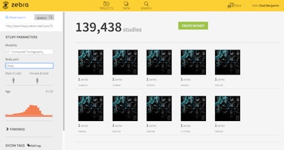 2015 05 14 08 49 46 667 Zebra Screenshot 800