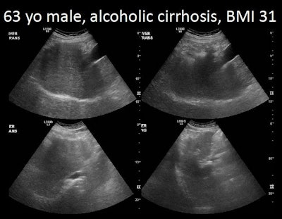 Examples of poor-quality (above) and good-quality (below) images. All images courtesy of Dr. Yuko Kono, PhD.