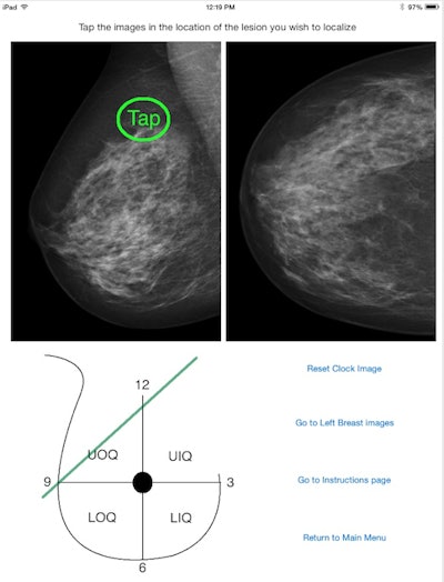 Mammography Localizer helps residents learn to localize lesions on screening mammograms by showing locations on a clockface schematic of the breast. Image courtesy of Dr. John Bisges.