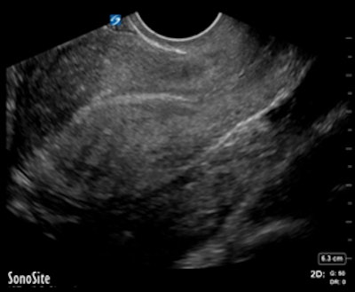 ER-performed ultrasound
